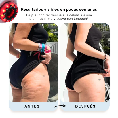 Smooch® | SculptGlow® – Piel más firme y tonificada